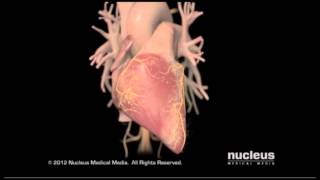 Heart Failure Overview