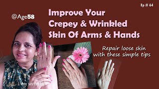 How To Tighten Wrinkles & Loose Skin On Arms | Wonderful Tips To Improve Crepey Skin Of Hands |