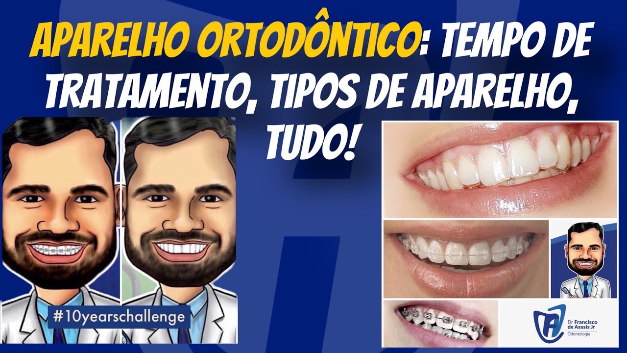 Francisco De Assis Almeida Lima Júnior-77