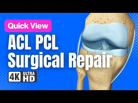 ACL PCL Surgical Reconstruction // See How It Works // 3D Animation