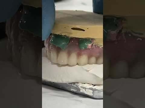 Denture Relining from Start to Finish #dental #teeth #smile #dentures #shorts #lsk121shorts