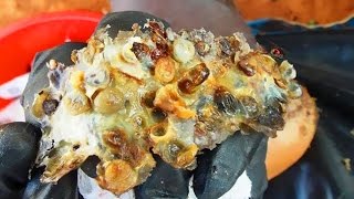 Jiggers Deep in Joseph&#39;s Feet! Best Treatment this Month!