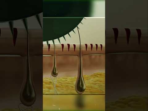 How Derma Roller Works #medical3danimation