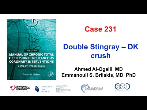 Case 231: Manual of CTO PCI - Double Stingray + DK crush