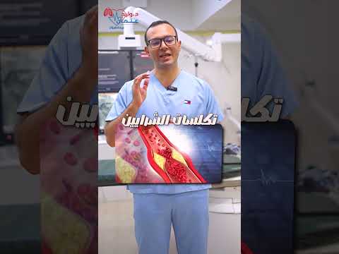 هل تكلس الشرايين التاجية خطير؟ شاهد الإجابة مع د. وليد عتمان 🩺❤️
