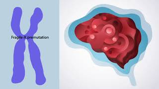 Understanding neurodevelopmental disorders and the people they affect