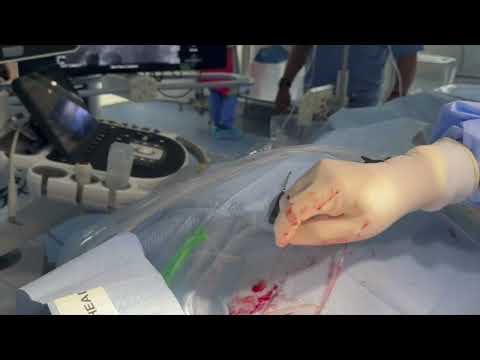 Ajay Wakhloo, Neurofine - Develops treatment drugs | LSI USA '26