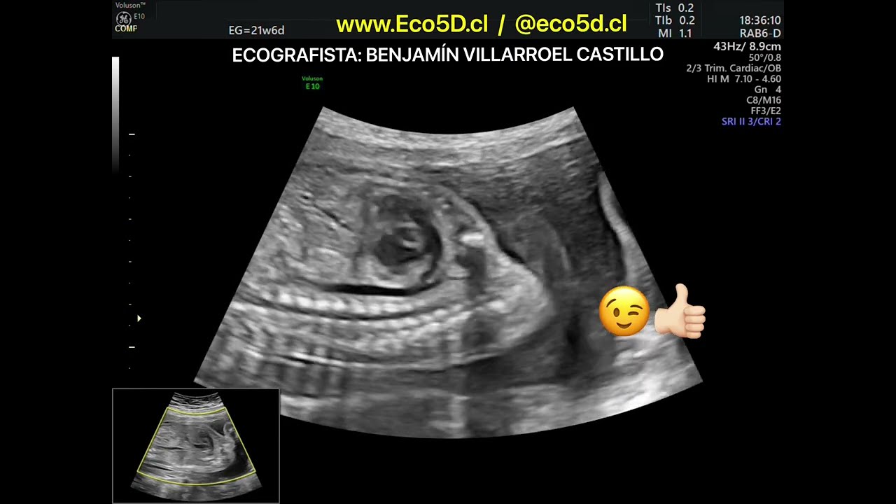 Benjamín Villarroel Castillo-21