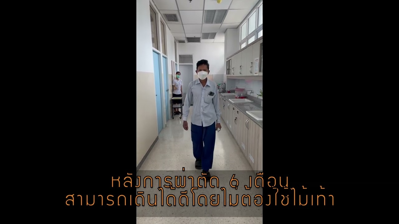 การผ่าตัดเปลี่ยนข้อสะโพกเทียม : คนไข้ข้อสะโพกเสื่อม ปวดข้อสะโพกมาก จนเดินลำบากมาหลายปี