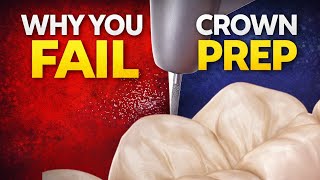 How Crown Prep Is Evaluated 🦷 (NDECC | ADC | Bench Test)