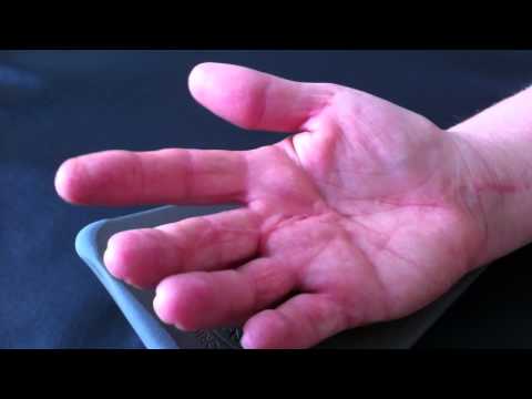 Angst mit Schiene zu Üben