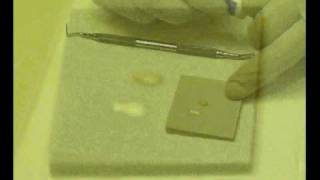 Download lagu Mixing Dycal Calcium Hydroxide mp3 Download lagu Mixing Dycal Calcium Hydroxide mp3