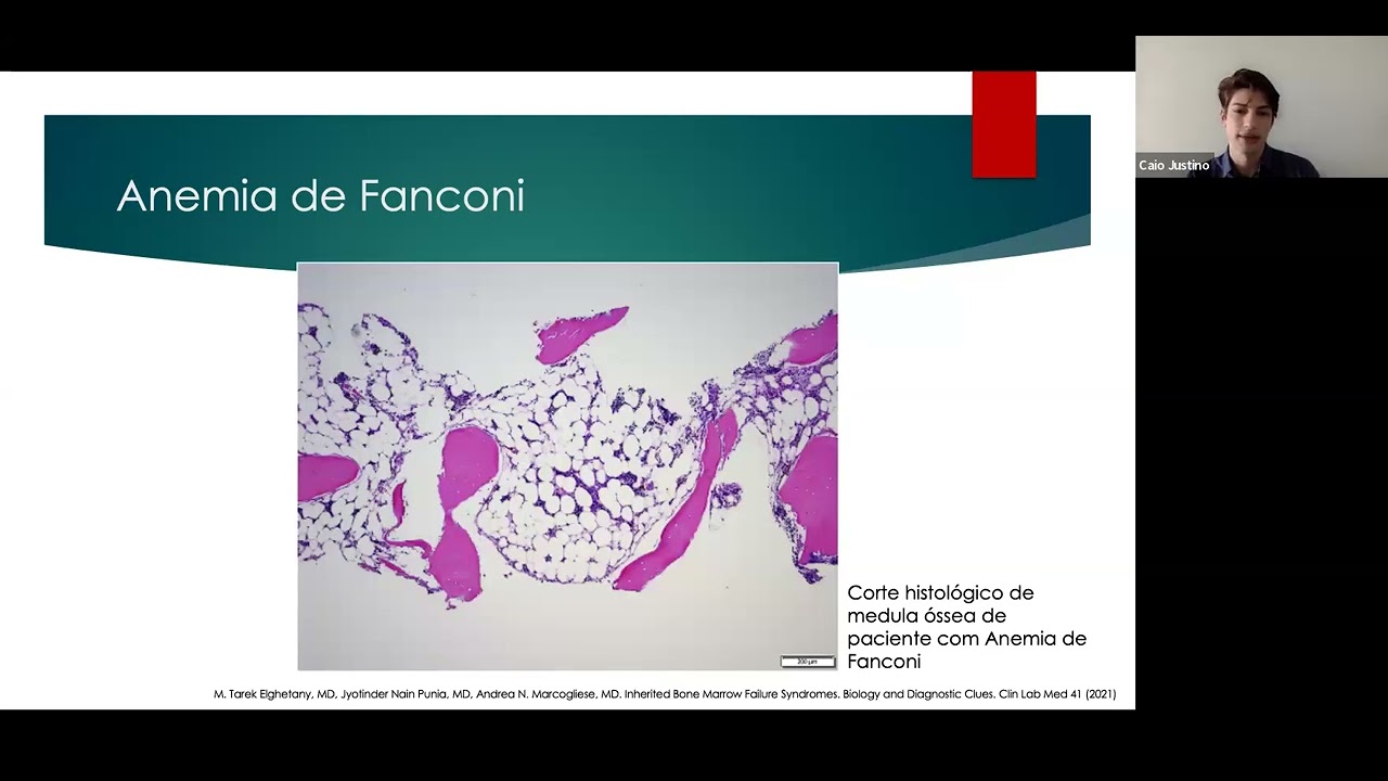 Aulas da Disciplina de Hematologia e Hemoterapia da UNIFESP