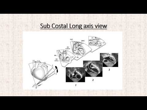 Pediatric Echo for the Adult Technologist: The Views
