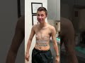 FTM Top Surgery Reveal
