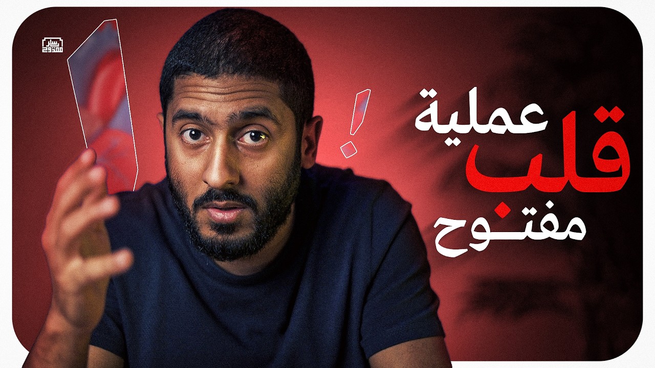 عملية قلب مفتوح #فيديو_الجمعة_ياسر_ممدوح