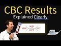 Complete Blood Count / CBC Interpretation (Leukocytosis) Complete Blood Count / CBC Interpretation (Leukocytosis)