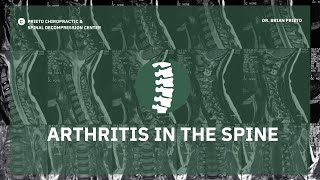 preview picture of video 'Arthritis in the Spine - Yorba Linda Orange County CA Chiropractor'