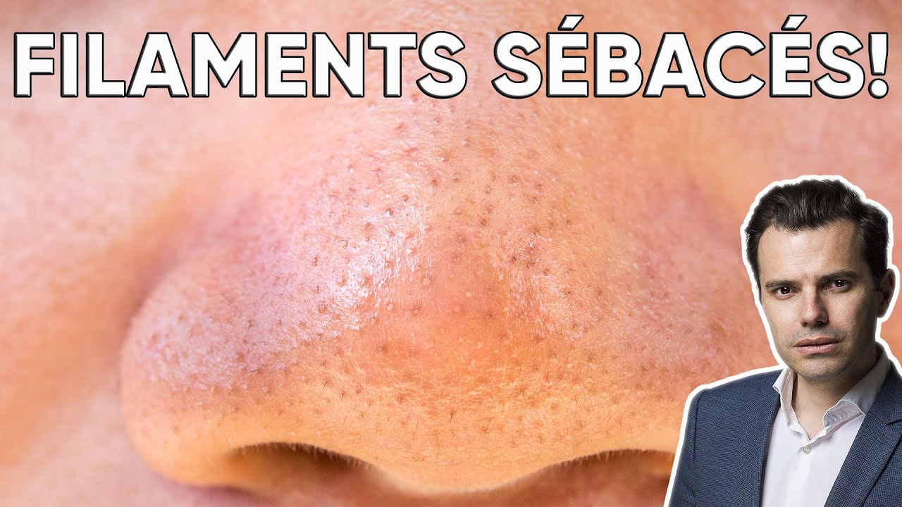 POINTS NOIRS SUR LE NEZ?  Avoir une peau lisse!