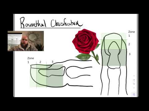 Rosenthal Classification of Nail Bed Injuries