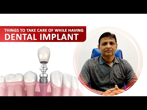 Immediate post operative Care For Dental Implants | Dr. Anand Jasani | City Dental Hospital