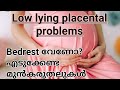Placental Positions in Pregnancy -All you need to know(മറുപിള്ളയുടെ സ്ഥാനം) Malayala