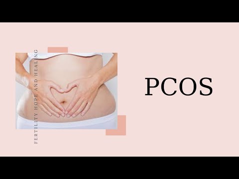 PCOS Myths Debunked and How to Manage Symptoms