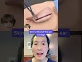 Watch How Ear Pinning Otoplasty Surgery Works Shorts Otoplasty