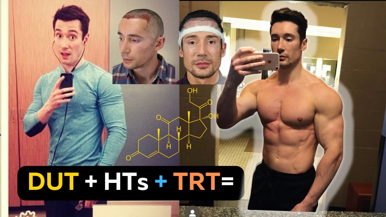 PART 1 HTN Podcast Ep 18- TRT, Dr. GABEL HT, and DUTASTERIDE