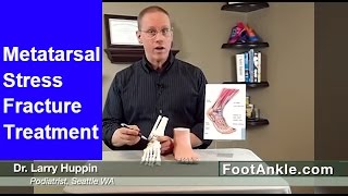 Metatarsal Stress Fractures - How to Diagnose Yourself
