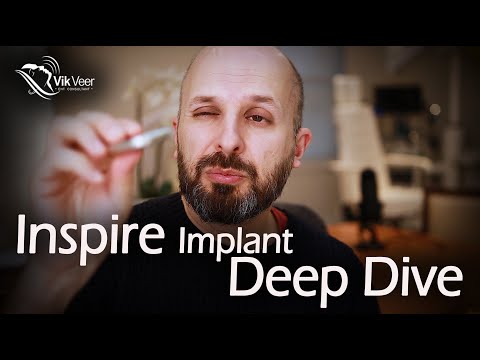 Inspire Implant — How it Works