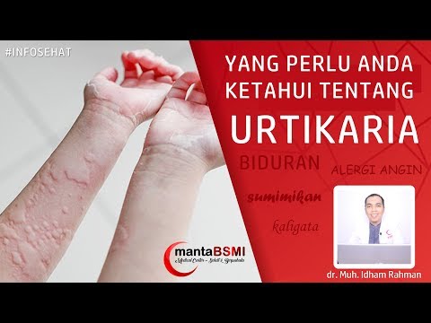 Yang perlu anda tahu tentang Biduran / Alergi Dingin / Urtikaria
