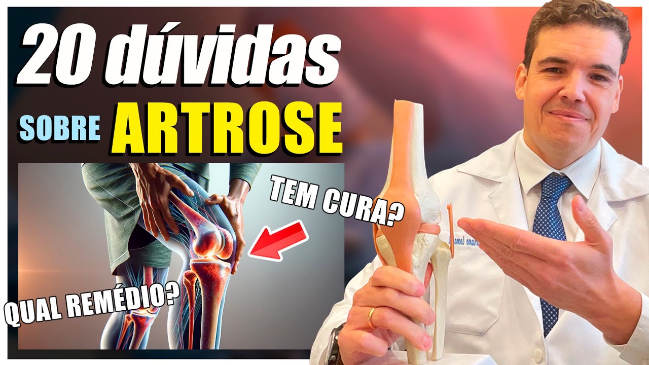 20 PRINCIPAIS DÚVIDAS SOBRE ARTROSE