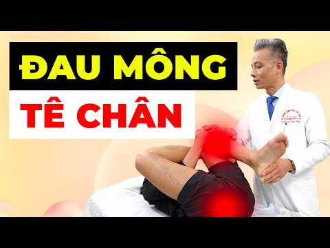 Tại sao tê mông lan xuống chân? 80% do chèn ép thần kinh – Đừng chủ quan!