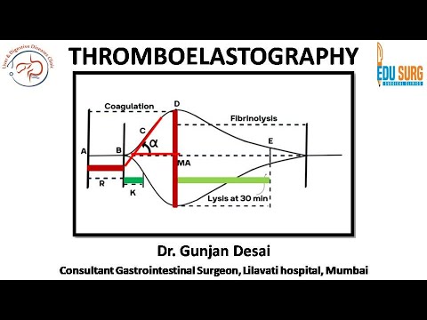 Thromboelastography - TEG coagulation test explained, interpretation of TEG Graph - Edusurg Clinics
