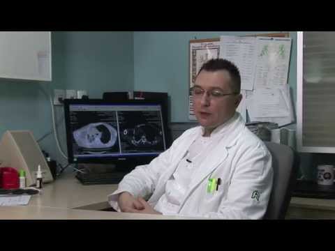 Simptomi i rano otkrivanje karcinoma pluća