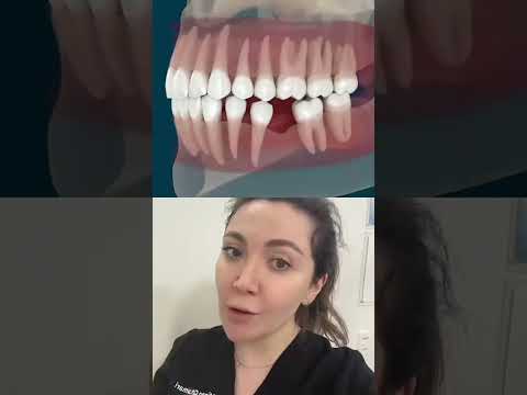 What Happens When A Tooth Is Removed?