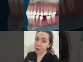 What Happens When A Tooth Is Removed?