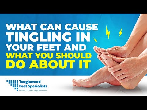 What Can Cause Tingling in Your Feet? It's Not Just Neuropathy!