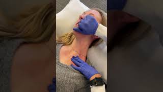 Platysma exercise part 1