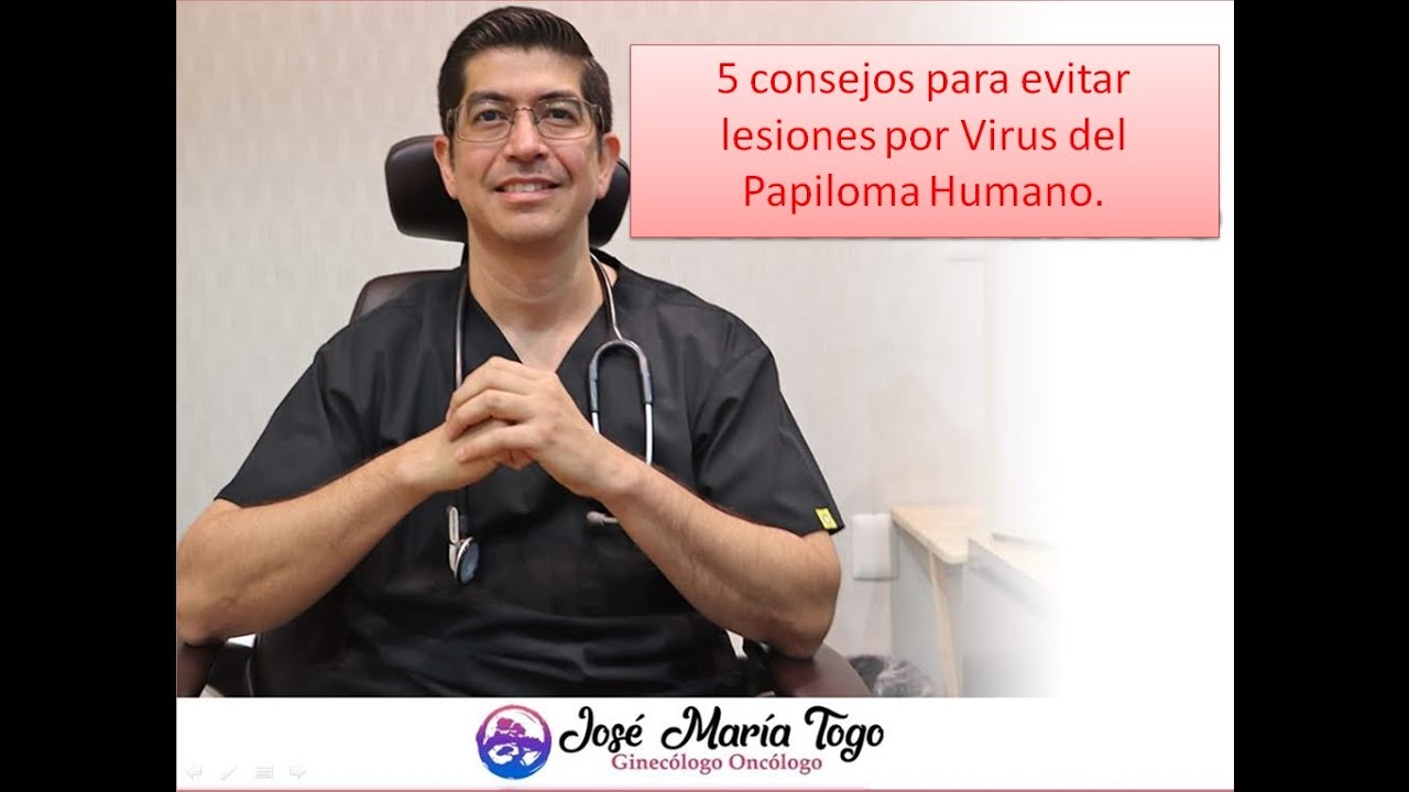 José María Togo Peraza-13