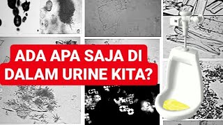 Penasaran, Beginilah hasilnya jika urine kita dilihat dimikroskop