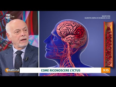 Stroke: Causes and Prevention - Unomattina 20/05/2024