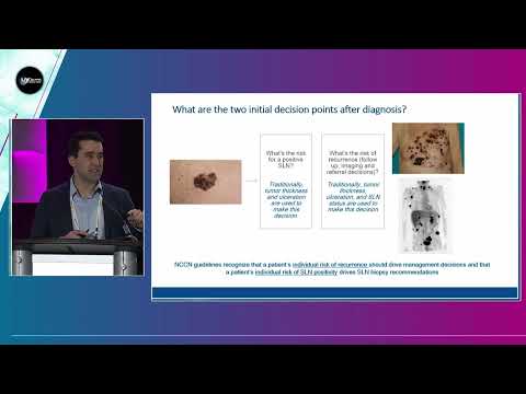 Genetic Approaches to the Prognosis of Cutaneous Melanoma