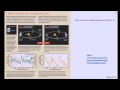 Lecture 21 11 Precession Of The Earth