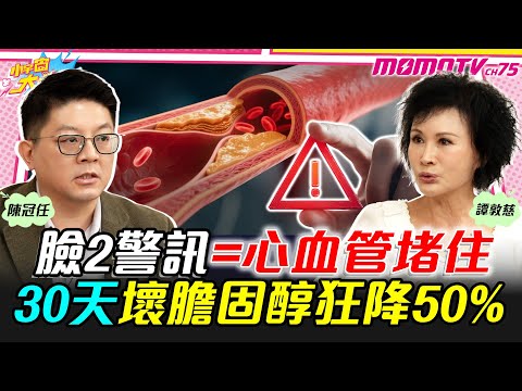 臉2警訊=心血管堵住 30天壞膽固醇狂降50% ft. 醫師 陳冠任 譚敦慈【 小宇宙大爆發 】