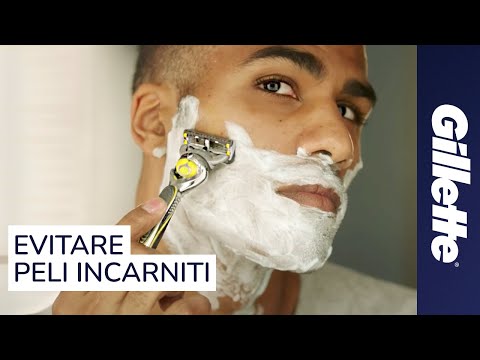Come liberarsi da konopushka su una faccia in 1 giorno Il pigmentary nota su un modello del corpo