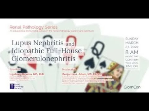 Lupus Nephritis and Idiopathic Full House Glomerulonephritis