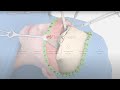 IPS Transformation Facial Feminization Surgery