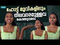 യെസ്‌മ സീരീസ് നാൻസിയിലെ അഞ്ജന Yessma Nancy Actre